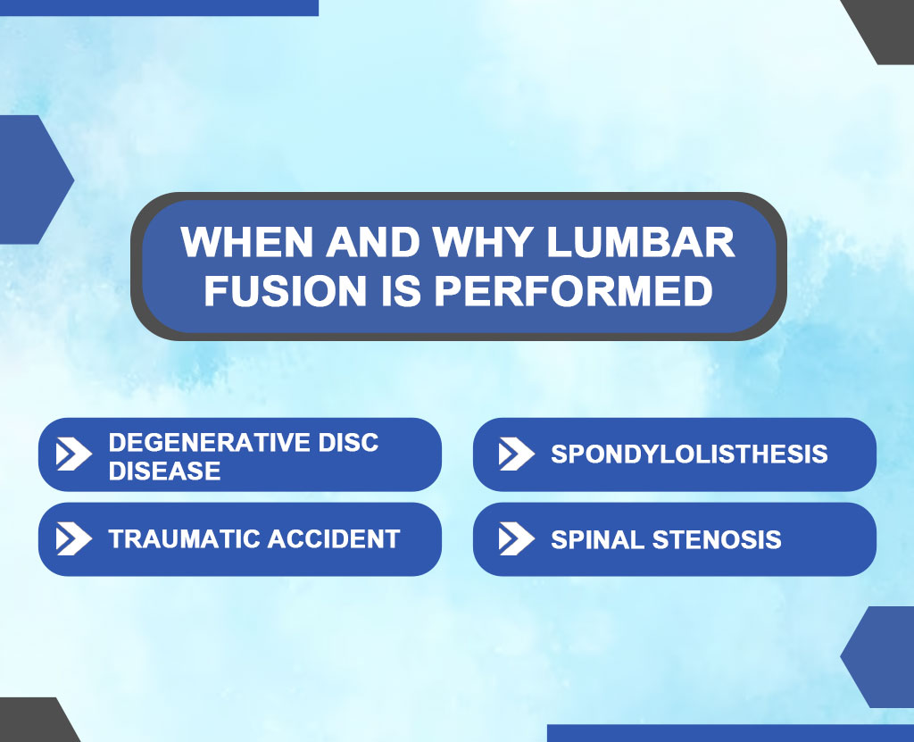 icd 10 cm code for status post spinal fusion